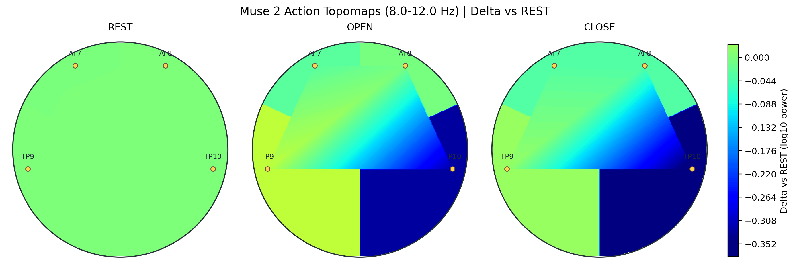 Action alpha rest-delta topomap